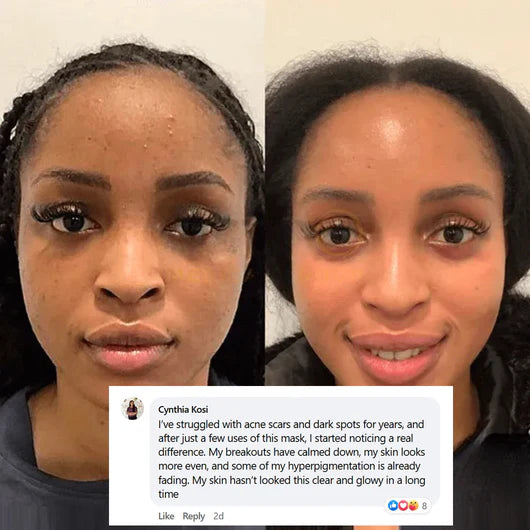 Masque Nuit Lyrée: 3X Collagène Booster